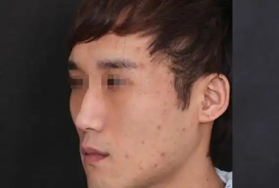 驼峰鼻的男人的命运:生性冷漠意志力强个性偏执容易失败