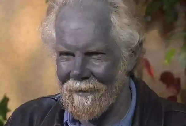 美国出现罕见的蓝种人:血液呈蓝色,隐居在6千米高山上百年_马丁·福