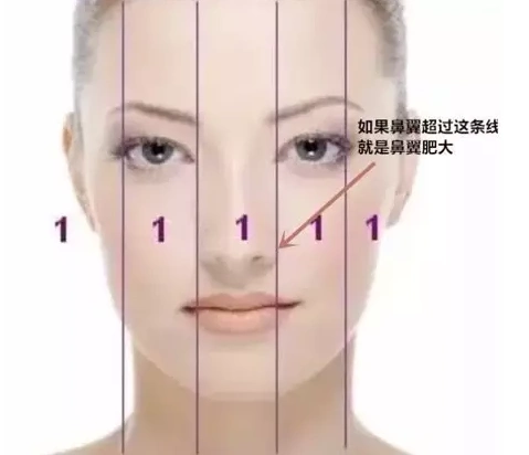 怎么改变鼻翼过宽?【云南华美美莱】