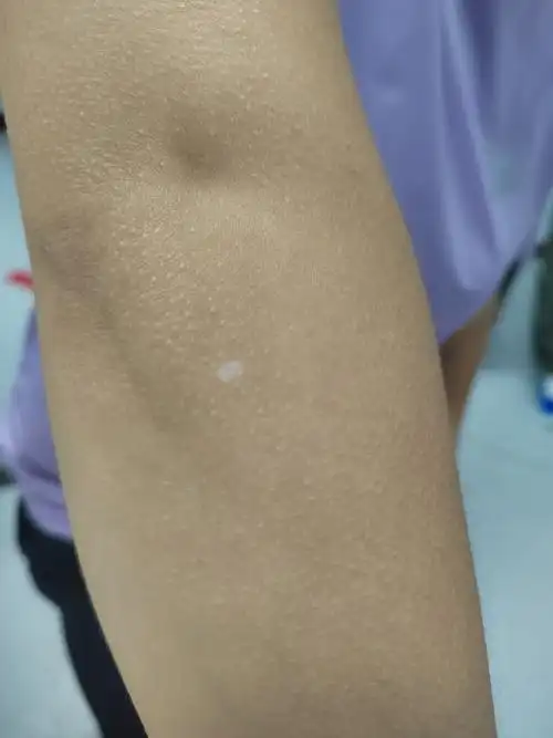 解决皮肤问题专注皮肤美容##白癜风