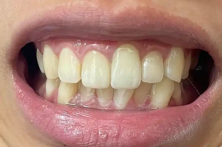 请一定保护好牙齿07