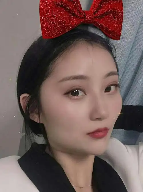 南昌韩美双眼皮芭比一样的眼睛