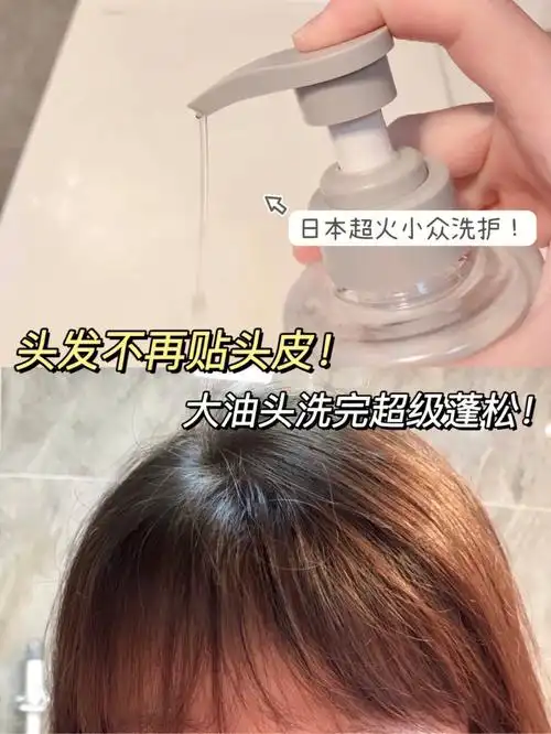 头发终于不贴头皮了这洗发水控油蓬松巨牛