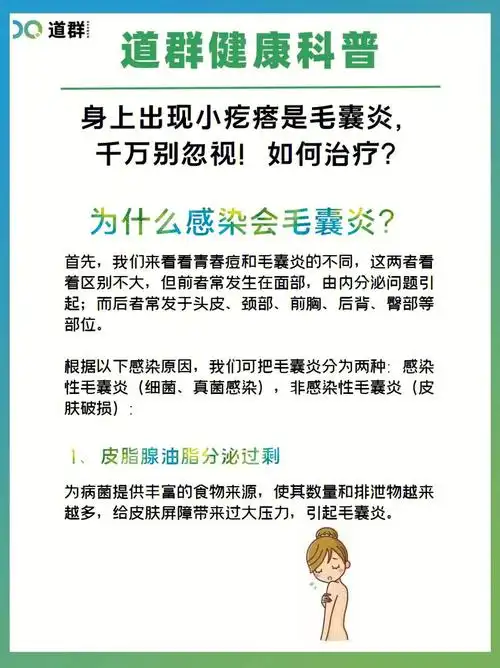 别忽视身上出现小疙瘩是毛囊炎如何治疗