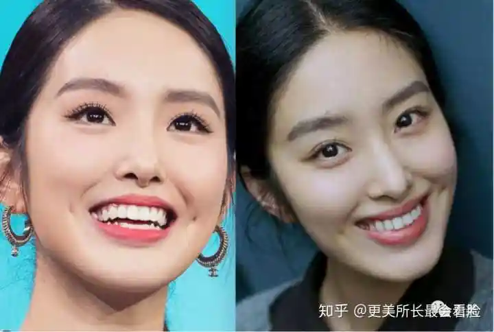 如何评价杨采钰的长相?