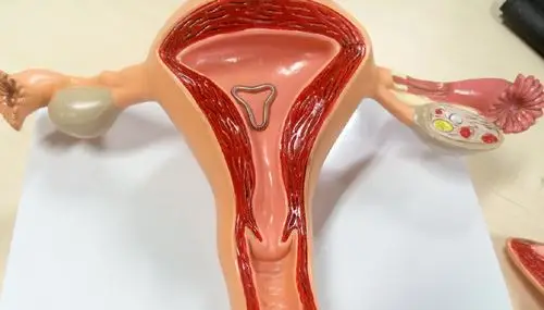 避孕环节育环宫内节育器到底是个啥