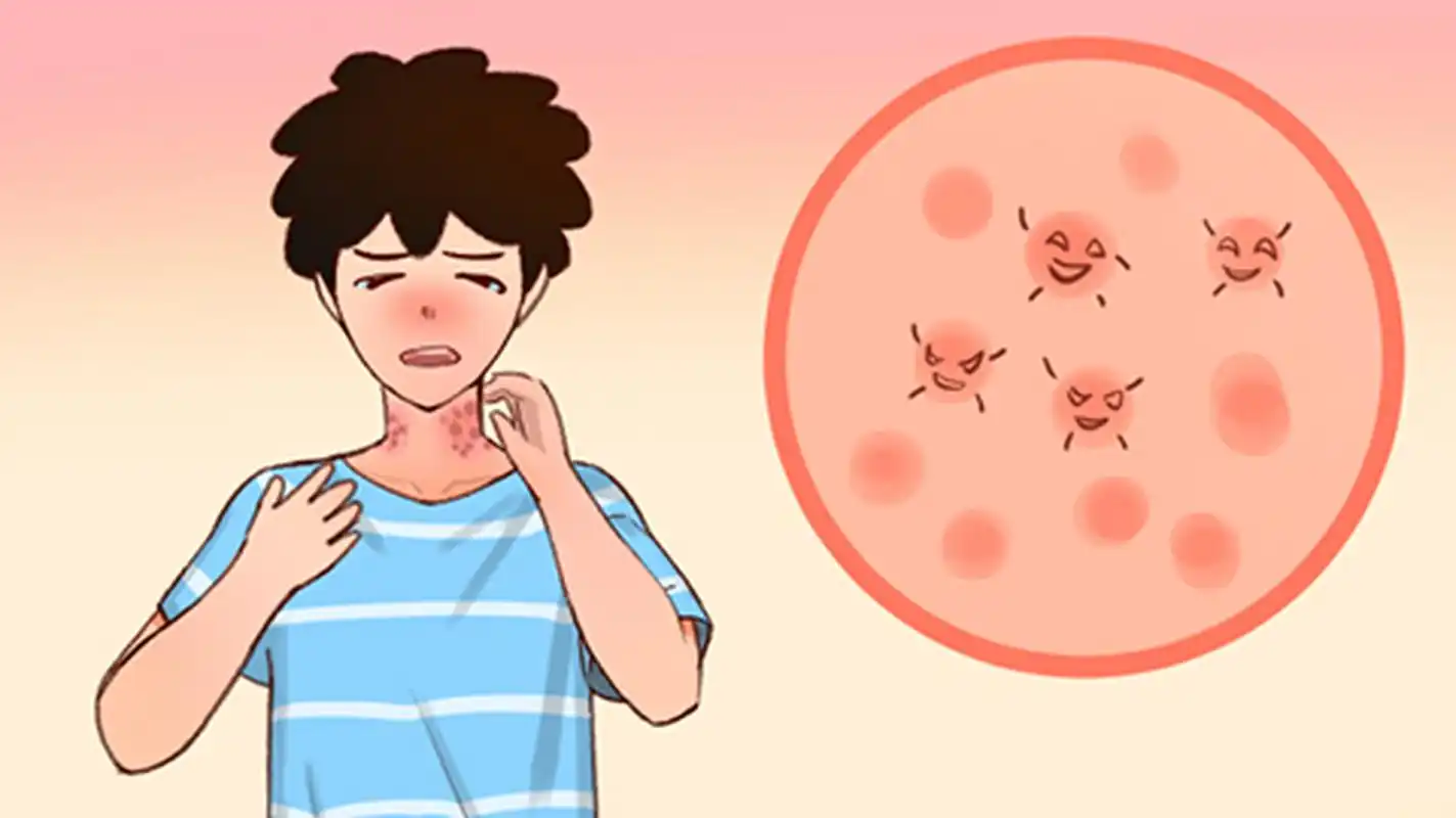 湿疹的辨别方法#南京皮肤病研究所# #湿疹# #南京看湿疹好的皮肤研究