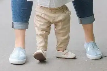 孩子走路八字脚到底需不需要矫正治疗