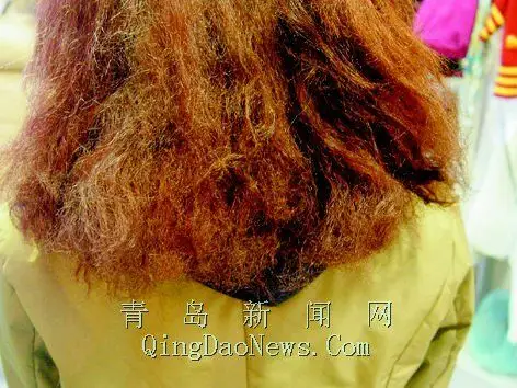厅烫了发,几天后,发现枕头上有很多断发,梳子一梳就会梳下大片头发,且
