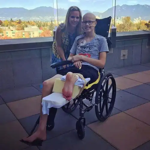 男孩大腿中有肿瘤,截肢后为正常生活,旋转180度脚后跟成新膝盖