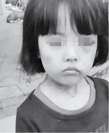 女孩苏丽3岁被针线缝嘴5岁被虐死生母出狱后竟将其挫骨扬灰