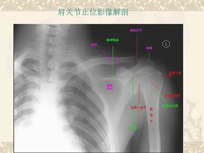 肩关节的摄影体位