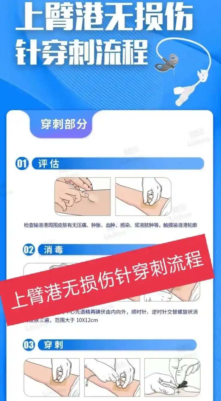 上臂港无损伤针穿刺流程#护士 #学医的女孩子 #静疗 #热࿆ - 抖音