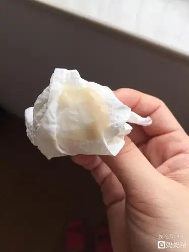 深厚!怀孕了白带是什么症状"不计其数"-第1张图片-君威博客