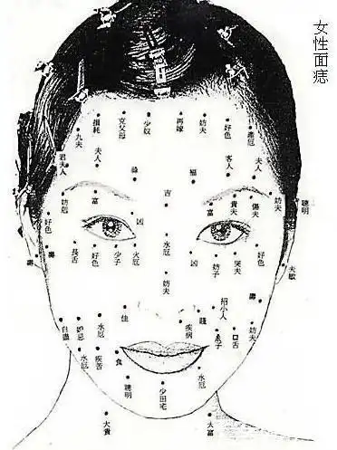 耳朵上长痣多为吉痣女人耳朵上长痣