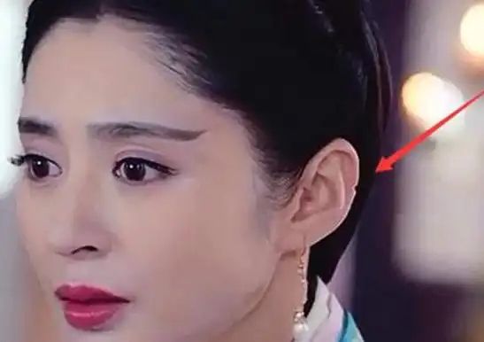 外耳廓缺了一小块面相