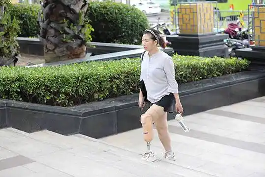 小腿假肢的正确穿戴方法_感觉_袜套_尼龙袜