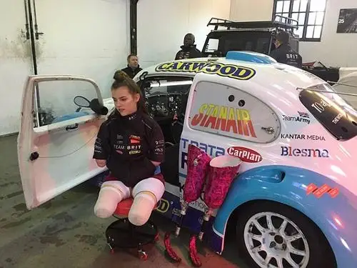 14岁蹦床冠军因病四肢截肢今成化妆女王还将成为赛车手