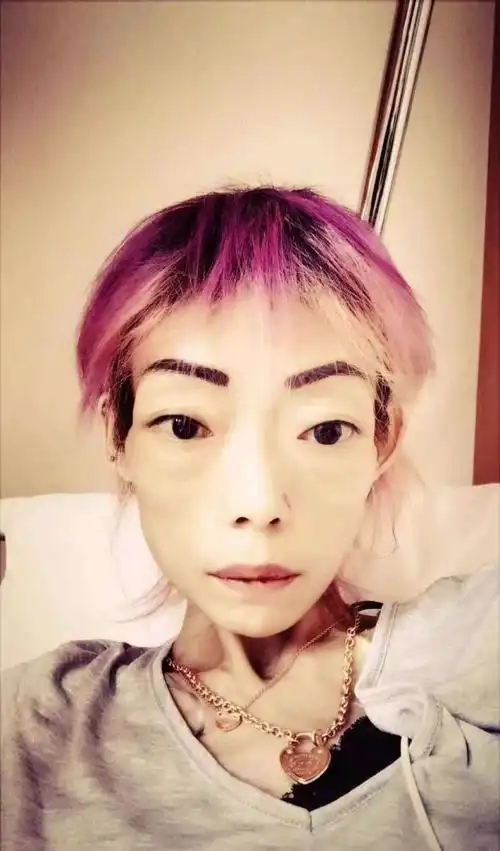 最惨正宫遭抛弃牙齿全掉暴瘦到44斤今病情严重卖收藏凑药钱