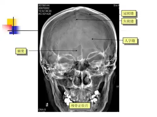 中枢神经系统 医学影像学本科五年制教材(第四版)