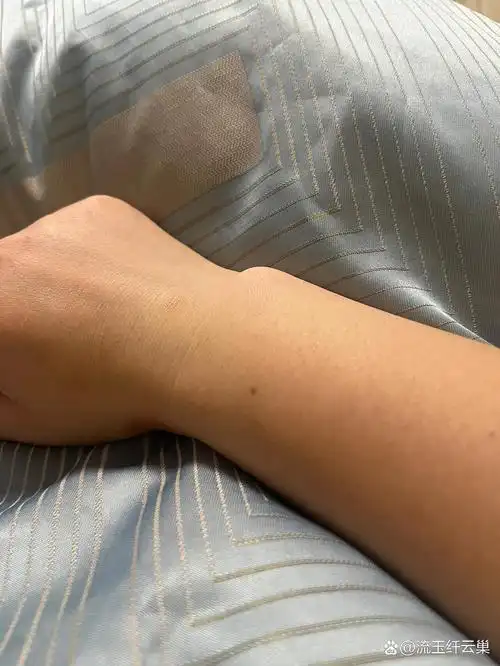 手腕长痣有什么说法吗?有多少同款的姐妹.