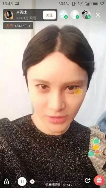 尚雯婕整容神似马里山!网友:鬼知道她经历了什么