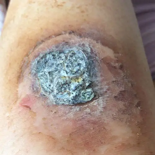 发霉少女的蜕变之路