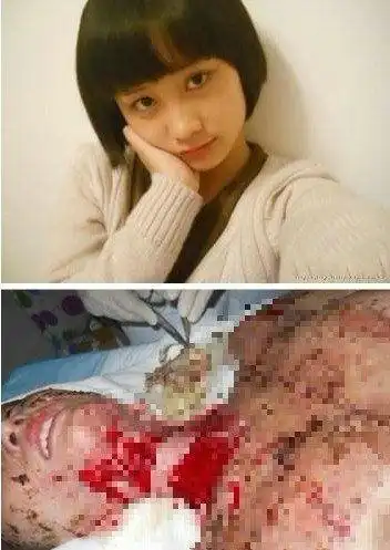 合肥17岁"最狠官二代"泼汽油焚烧少女 取保候审叫嚣杀人全家