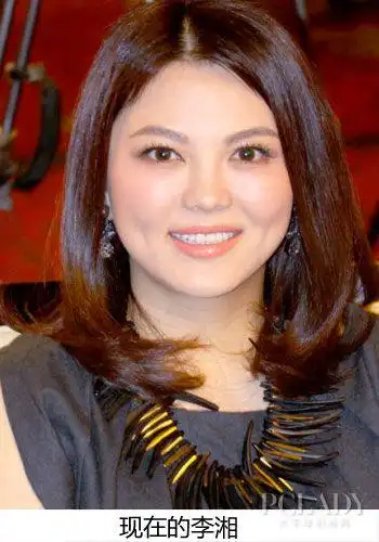 小脸变大饼脸女星 原来大饼脸这样造成