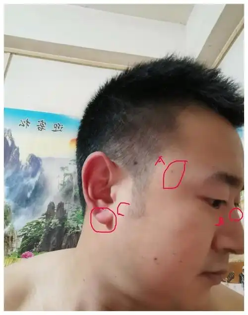 面相案例分析11