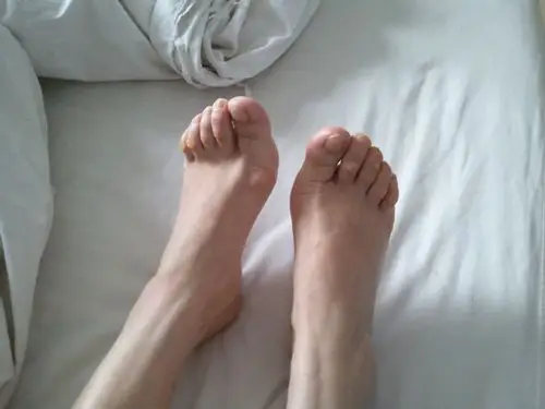 楼主中西医结合骨科2012-06-05 20:01:13   左足拇趾内侧疼痛5年.