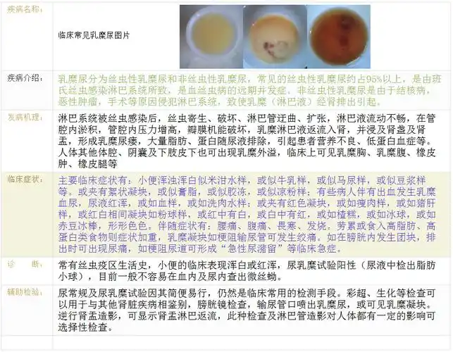 乳糜尿是怎么回事? - 好大夫在线