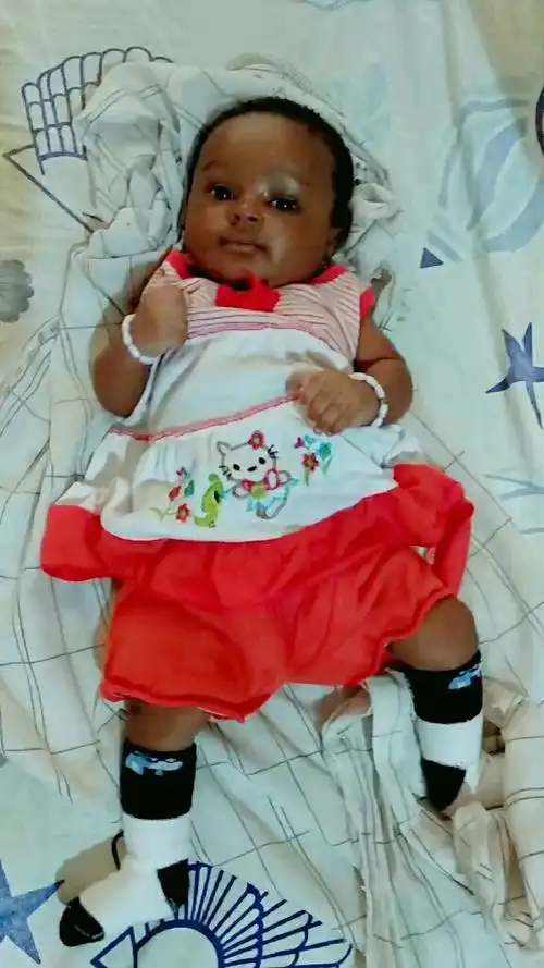 小黑孩越长越黑了,刚出生的时候全身就和手一样白的,现在就手还要白一