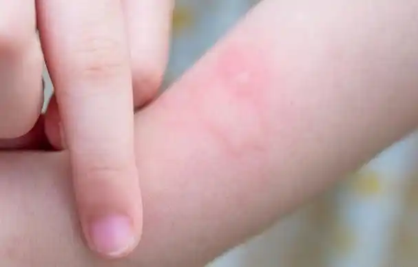 九成人不知道蟑螂天敌是什么屋内放上1个它蟑螂跑光