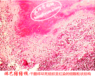 细胞死亡坏死凋亡