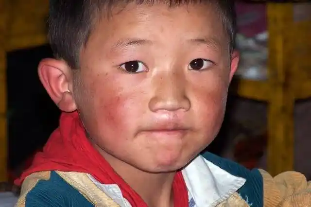 看看身边那些脸蛋干干红红的宝宝吧,颜值比起没出现"高原红"时明显