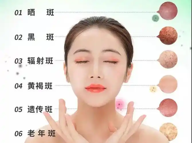 脸上长斑,二十多岁的年纪,有什么好产品祛斑吗? - 知乎