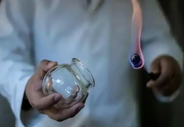 拔火罐吸出来的瘀血是身体里的毒素吗告诉你真相看完涨知识