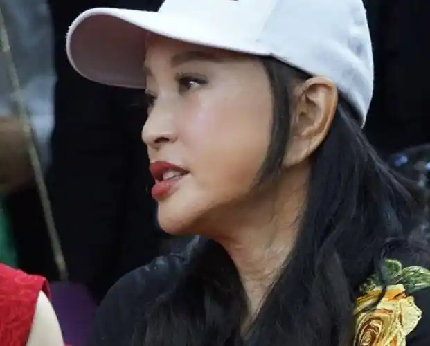 70岁刘晓庆"面具脸"太雷人,耳垂下巴都连在一起,能不能真实点_耳朵