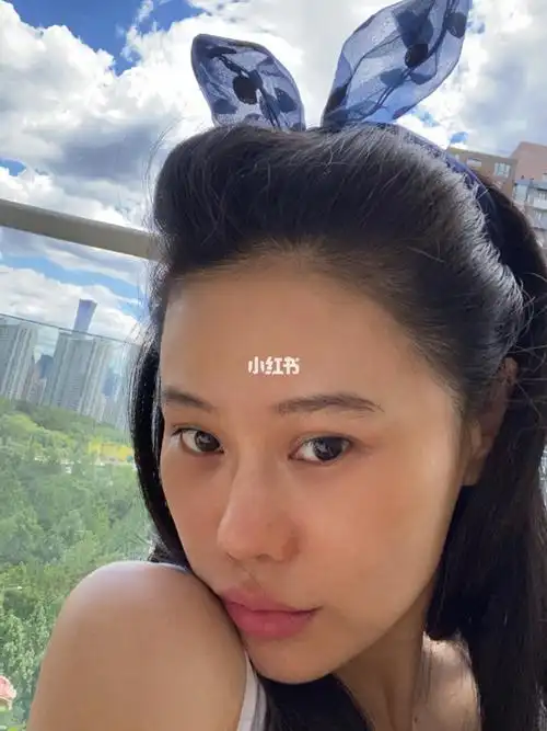 袁娅维这个小红鼻头哈哈哈!但是素颜太9315了!