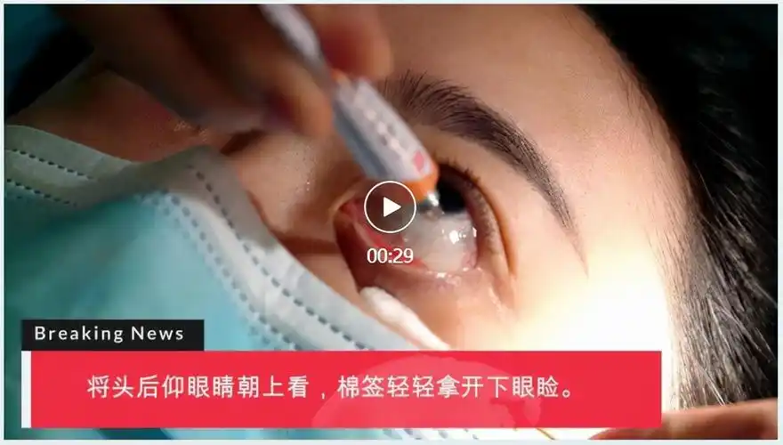 要清洗双手第一步第一次使用眼药膏,很多人都有疑惑,到底怎么涂到眼睛