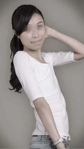 青岛权威自体隆胸医院-青岛诺德医学美容整形医院[官网]-贵妃无痕丰胸