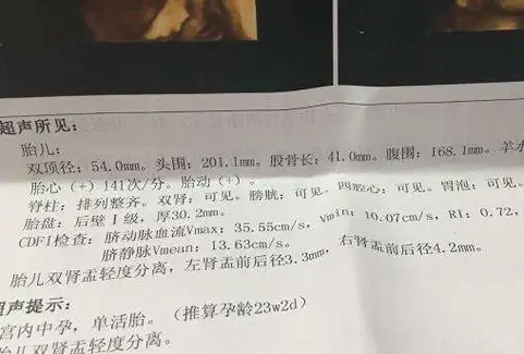 在b超单上,我们一般会发现这3个名词,双顶径就是头部最宽部位的长度