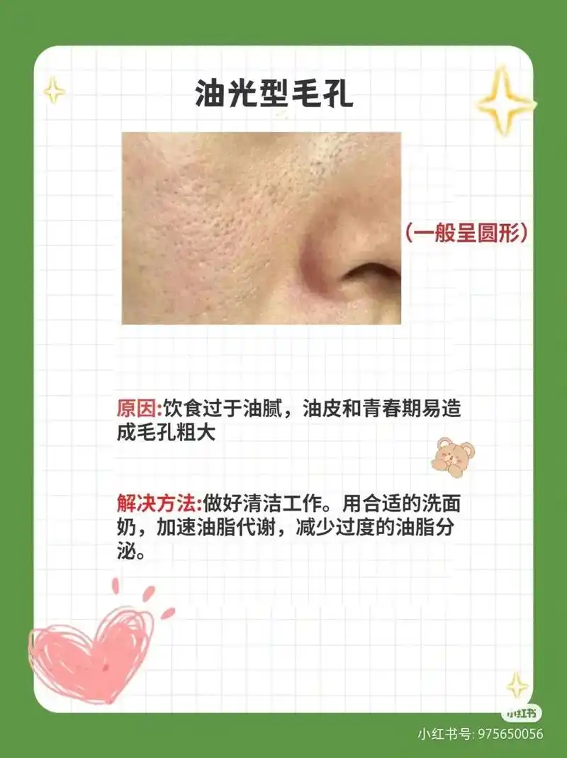 小杰美甲美睫店#清洁毛孔去黑头去粉刺 #皮肤白白嫩嫩  - 抖音