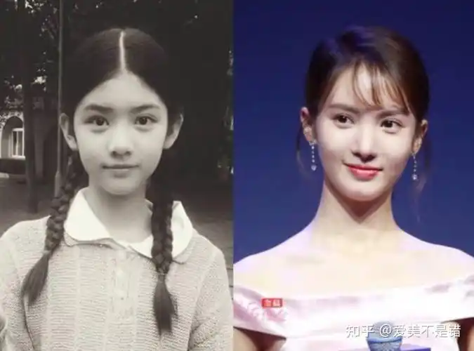 何晋龙解读北舞校花金晨为什么那么好看她到底整了哪里