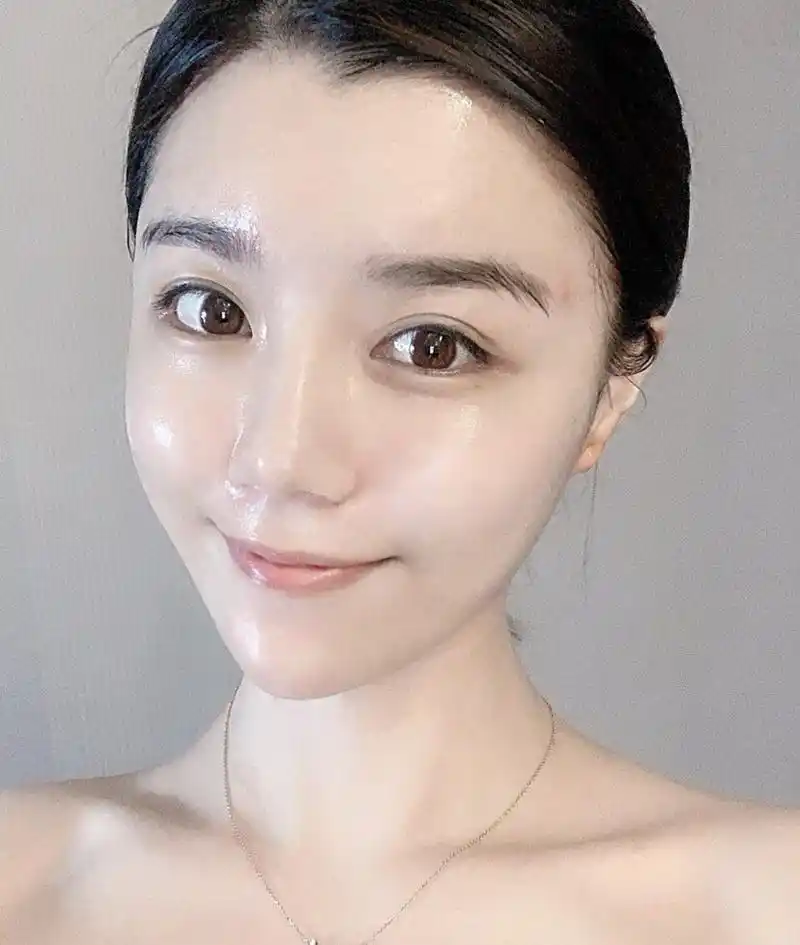 水氧活肤做完皮肤很舒服哦,水嫩光滑,哈哈,小姐姐人_圈子-新氧美容