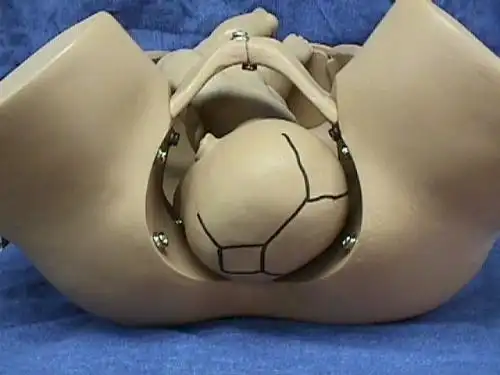 胎位图(loa/roa/lop/rop),jmm可以自己对照dd看下