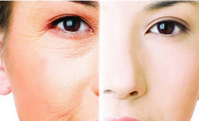 抗皱的食物有哪些?抗皱的方法有哪些呢?