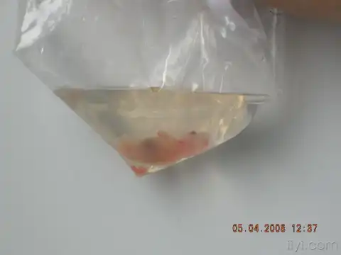 妊娠3个月胎儿图片 - 爱§为你盛开的日志 - 网