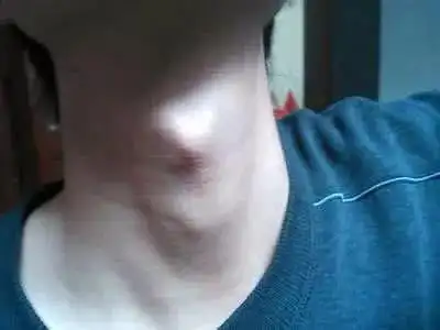 男生有喉结而大部分女生没有谁告诉你的事实是